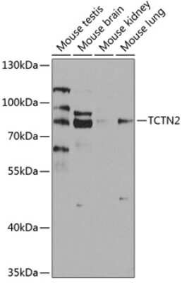 Western Blot: TCTN2 AntibodyBSA Free [NBP2-94043]